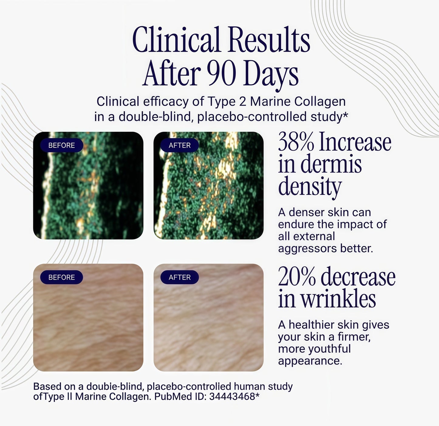 Rho Nutrition Liposomal Collagen Peptides - High-Absorption Liquid Collagen Supplement - Supports Skin Elasticity, Joint Health, and Overall Vitality for Healthy Aging, 5 fl oz